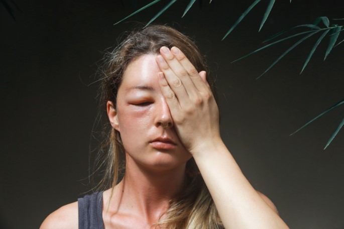 групи ліків перехресна алергія групи ліків перехресна алергія